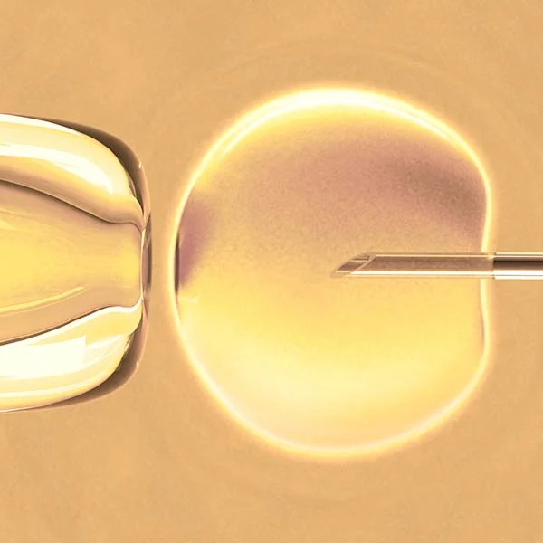 Fecondazione in vitro tramite ICSI (iniezione intracitoplasmatica di  spermatozoi) - Irma, clinica della fertilit